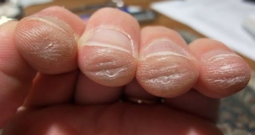 guitarist fingers