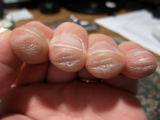 guitarist fingers