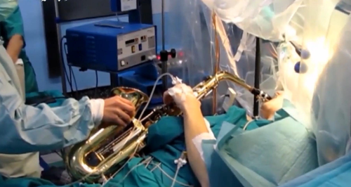 Saxophone brain surgery