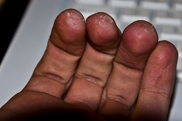 violinist fingers