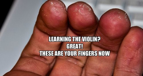 violinist fingers