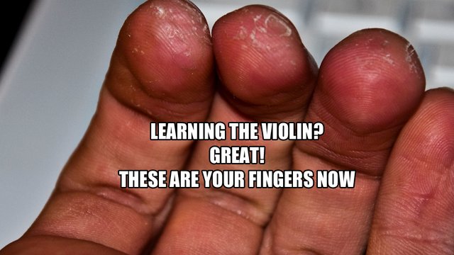 violinist fingers