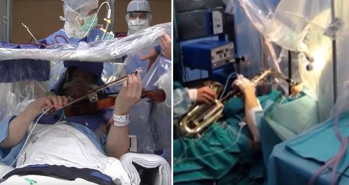 Musicians - brain surgery